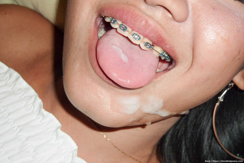 Thai Song's Shiny Metal Mouth Braces and Cum in the Mouth! - Song